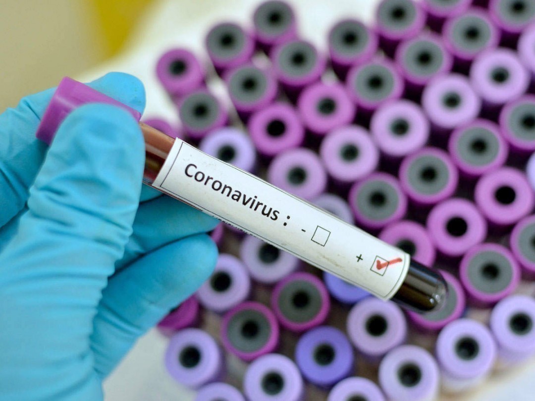 коронавірус
